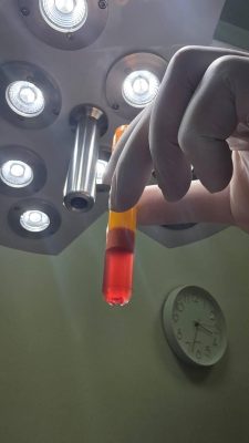 Tecnologias de medicina regenerativa. Tecnologias de medicina regenerativa.