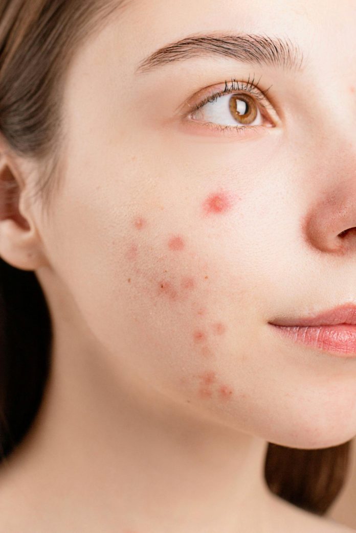 Dermatologista: 5 Sinais para Marcar Consulta