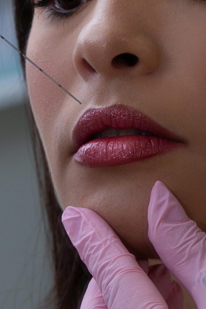 Preenchimento Labial: Mitos e Verdades